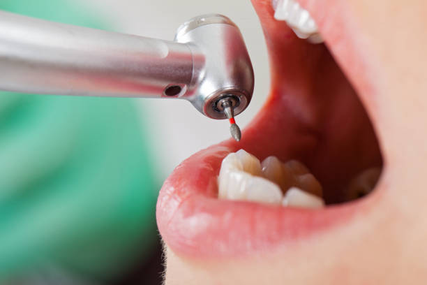 Best Walk-In Emergency Dental Services in Westwego, LA